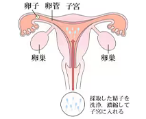 人工授精